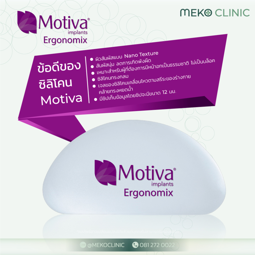 ข้อดีของซิลิโคน Motiva