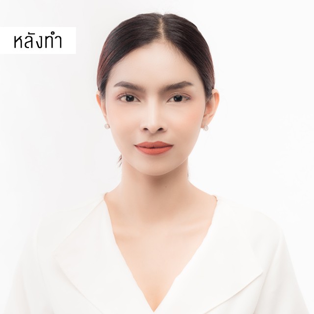 Botox หมอมิ้ว เมโกะ คลินิก คุณโฟม