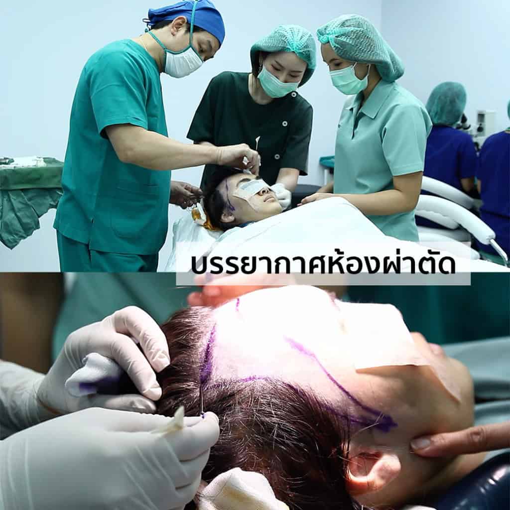 ปลูกผม หมอธิติวัฒน์ เมโกะ MHC คุณน้ำ