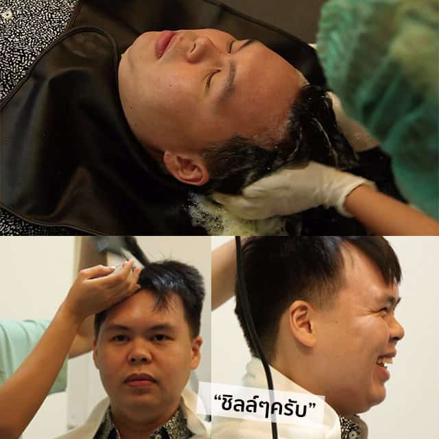 ปลูกผม หัวล้าน ผมบาง หมอธิติวัฒน์ เมโกะ MHCคุณวิกรม
