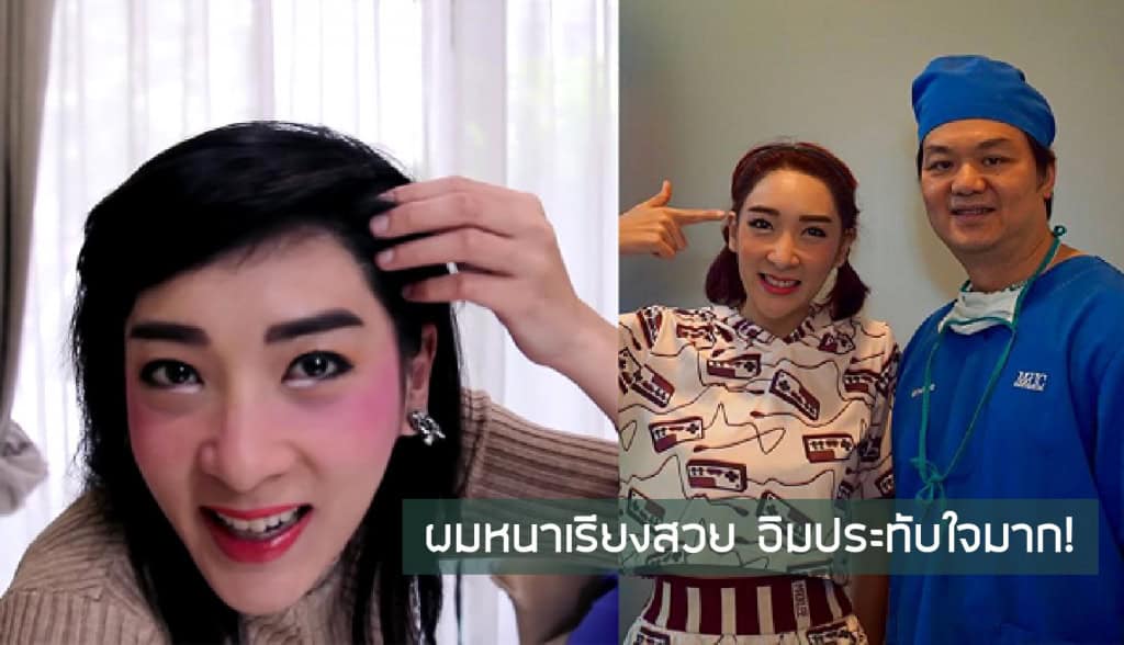 หนูอิมฟ้าว์เฟี้ยว-ปลูกผม-fut