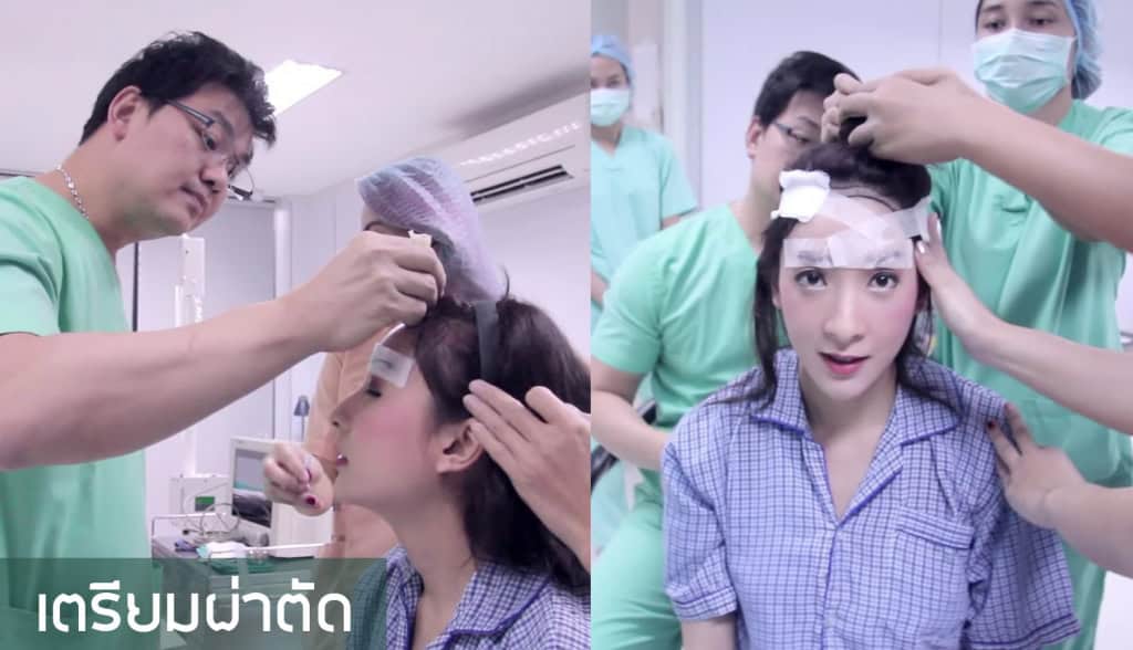 หนูอิมฟ้าว์เฟี้ยว-ปลูกผม-fut
