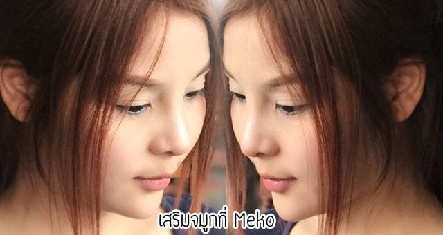 เสริมจมูก แก้จมูก โดยหมออา ที่เมโกะคลินิก คุณโบว์