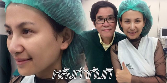 คุณทิพ-แก้จมูก-เสริมจมูก-หมอมนัส-เมโกะ คลินิก