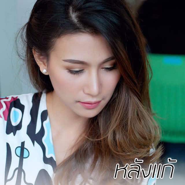 คุณทิพ-แก้จมูก-เสริมจมูก-หมอมนัส-เมโกะ คลินิก