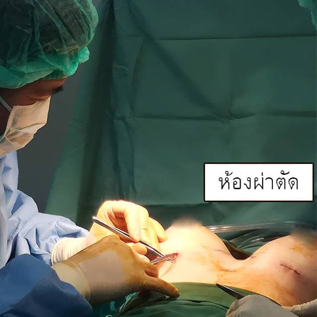 เสริมหน้าอก โดยหมอคม ที่ เมโกะ คลินิก คุณพลอยพัชชา