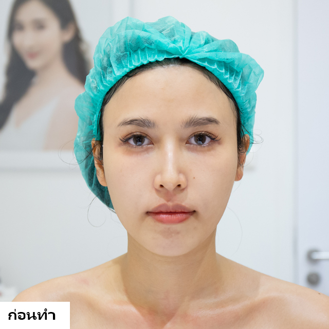 Ultarasignater dr.fon mekoclinic ploy