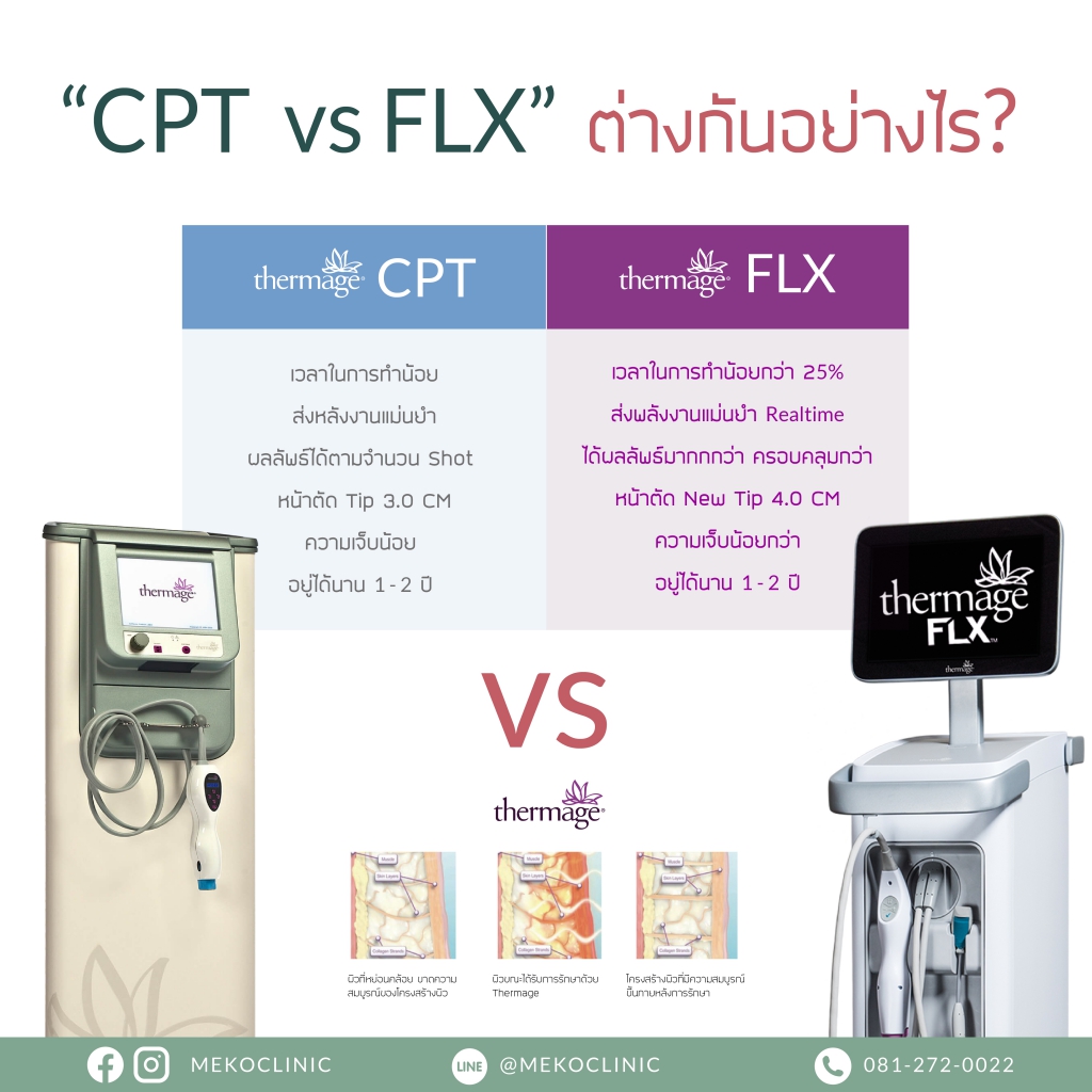CPT VS FLX ต่างกันอย่างไร