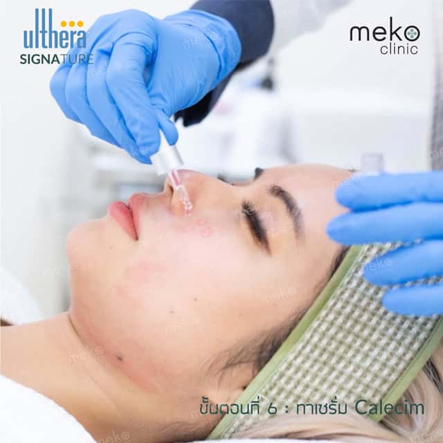 Ulthera Signature dr.ake mekoclinic