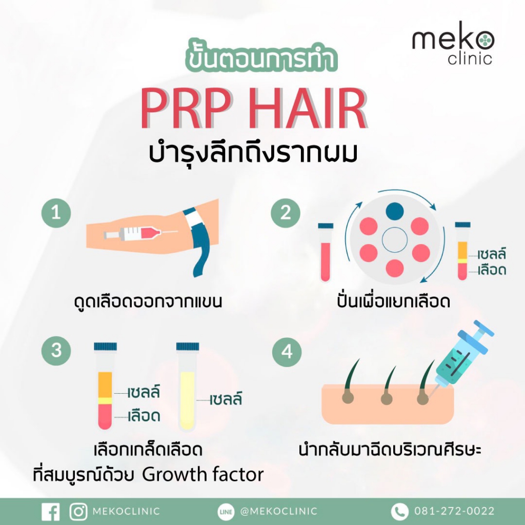 PRP THERAPY mekoclinic
