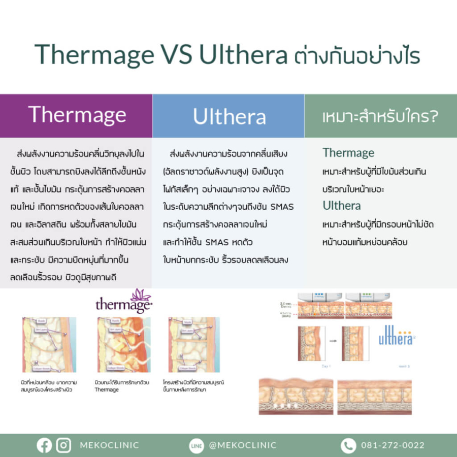 Thermage Vs Ulthera ต่างกันอย่างไร