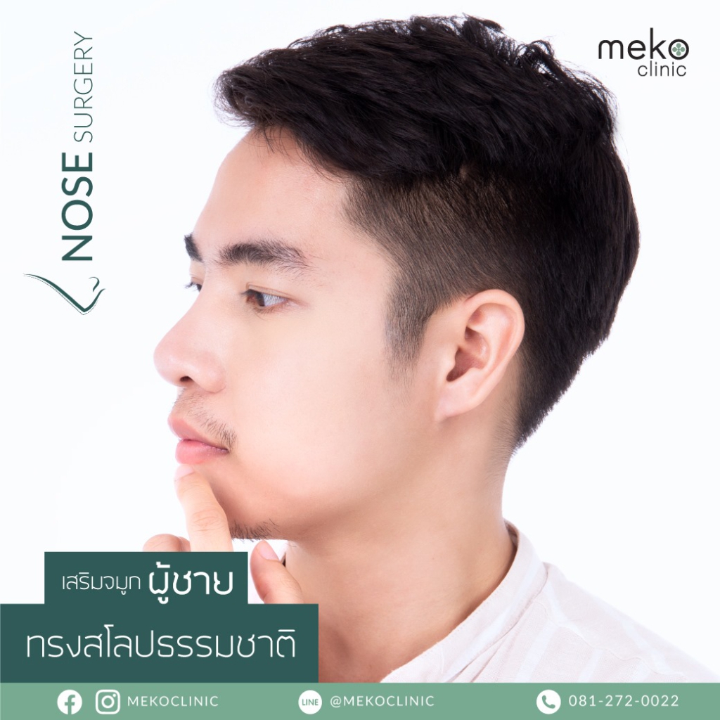 รีวิวเสริมจมูก-Nose-surgery-ทรงสโลป-ผู้ชาย-