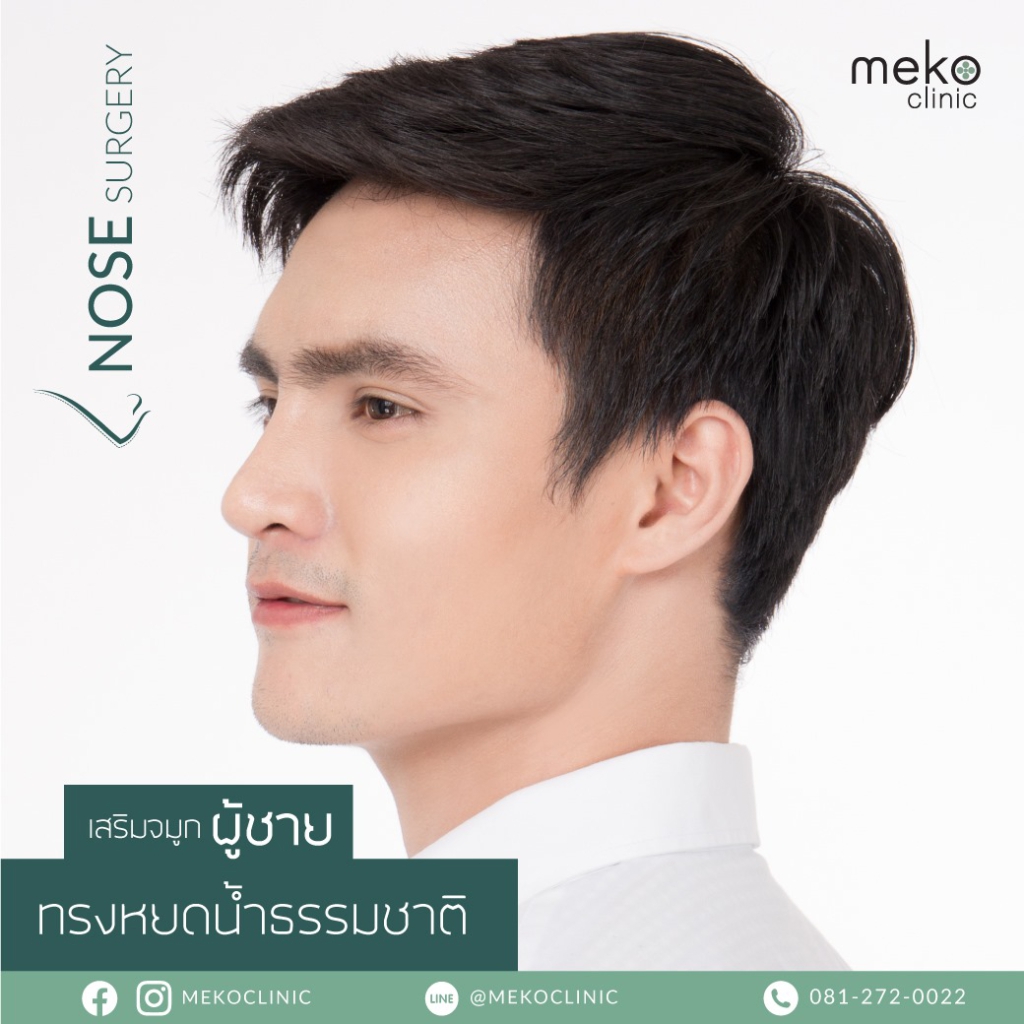 รีวิวเสริมจมูก-Nose-surgery-ทรงหยดน้ำธรรมชาติ-ผู้ชาย-2