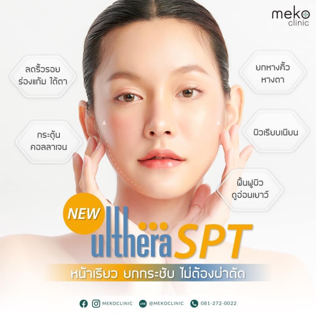 new ulthera SPT หน้าเรียว ยกกระชับ ไม่ต้องผ่าตัด -1