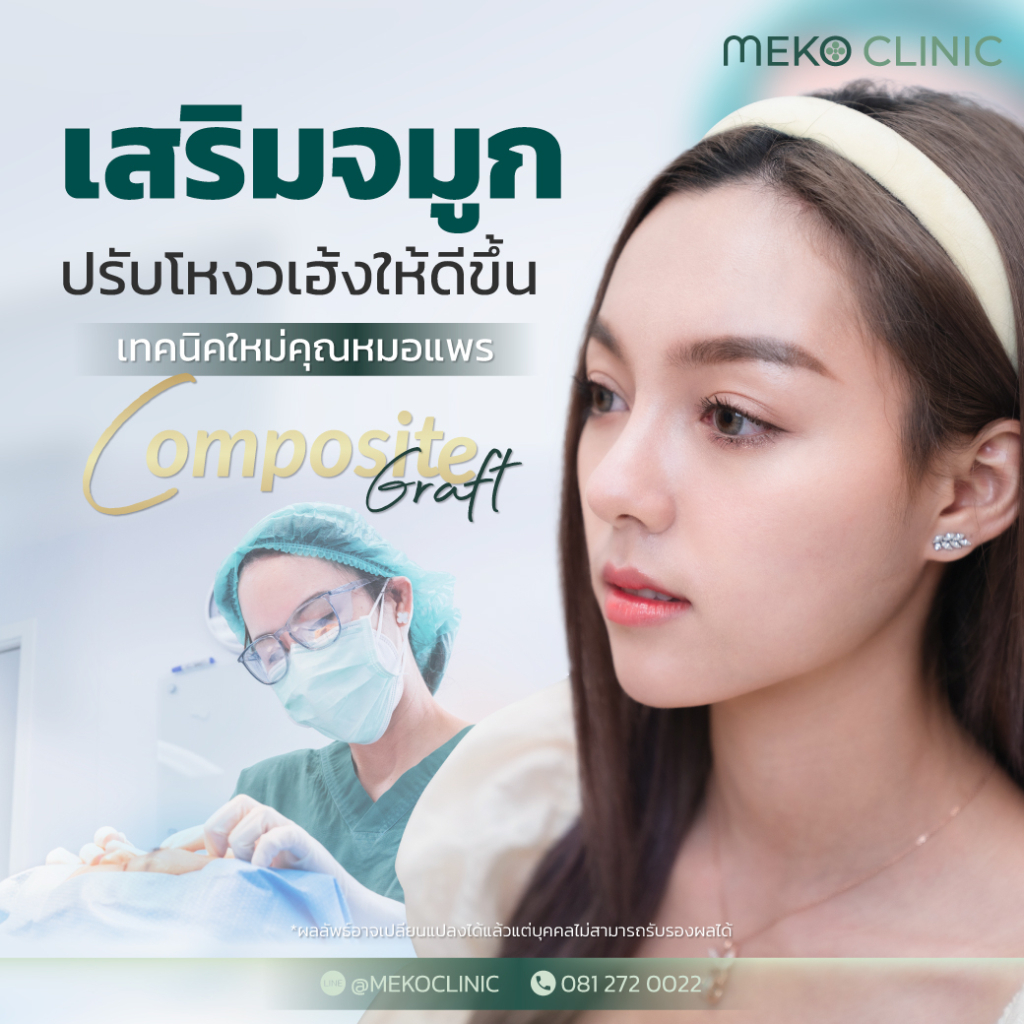 เสริมจมูกเทคนิค Composite Graft [By หมอแพร]1