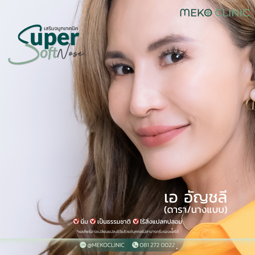 เสริมจมูก เทคนิค Supersoft Nose [ By หมอมนัส]1