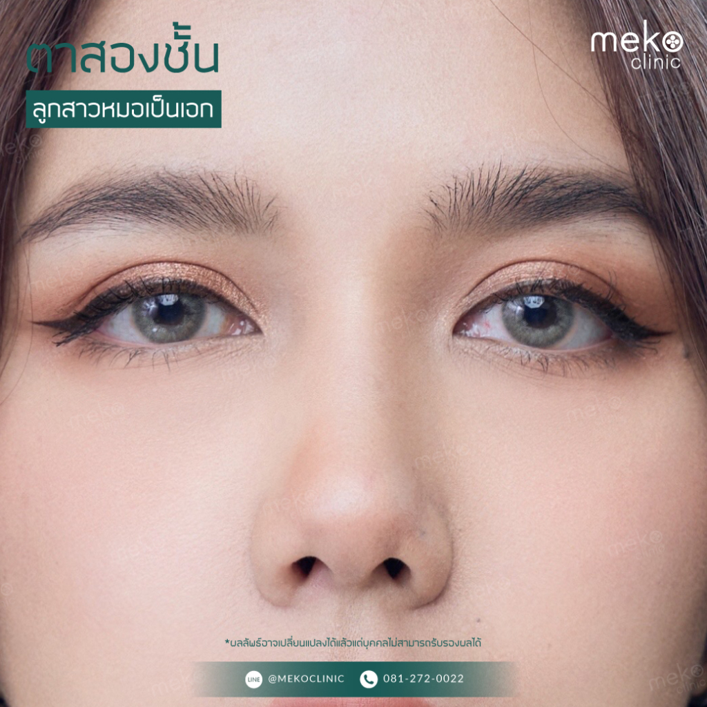 ตาสองชั้นลูกสาวหมอเป็นเอก-3