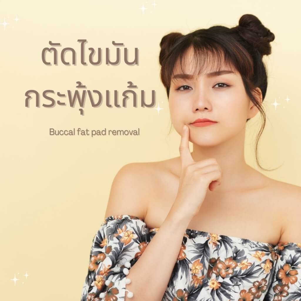 ตัดไขมัน-กระถ้งแก้ม-buccal-fat-pad-removal