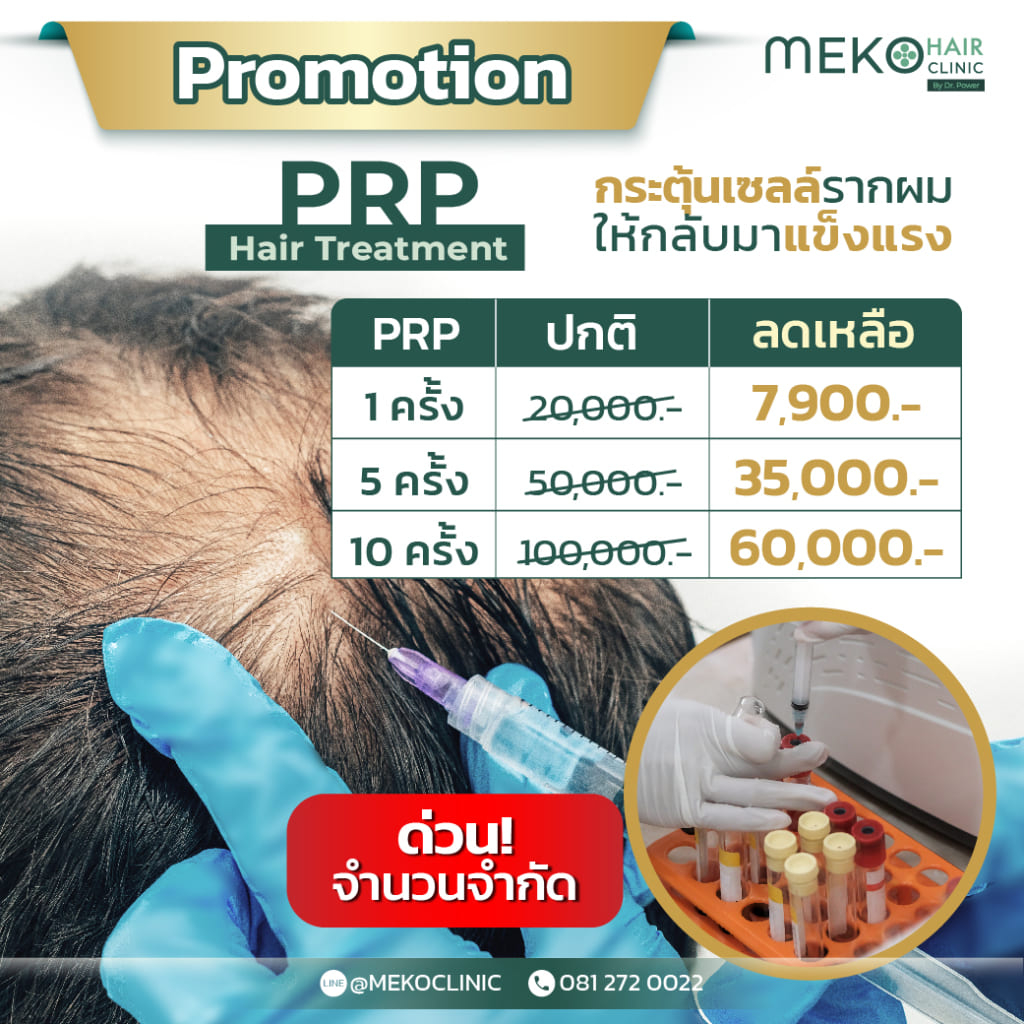 โปรโมชั่น promotion ทำ PRP hair treatment