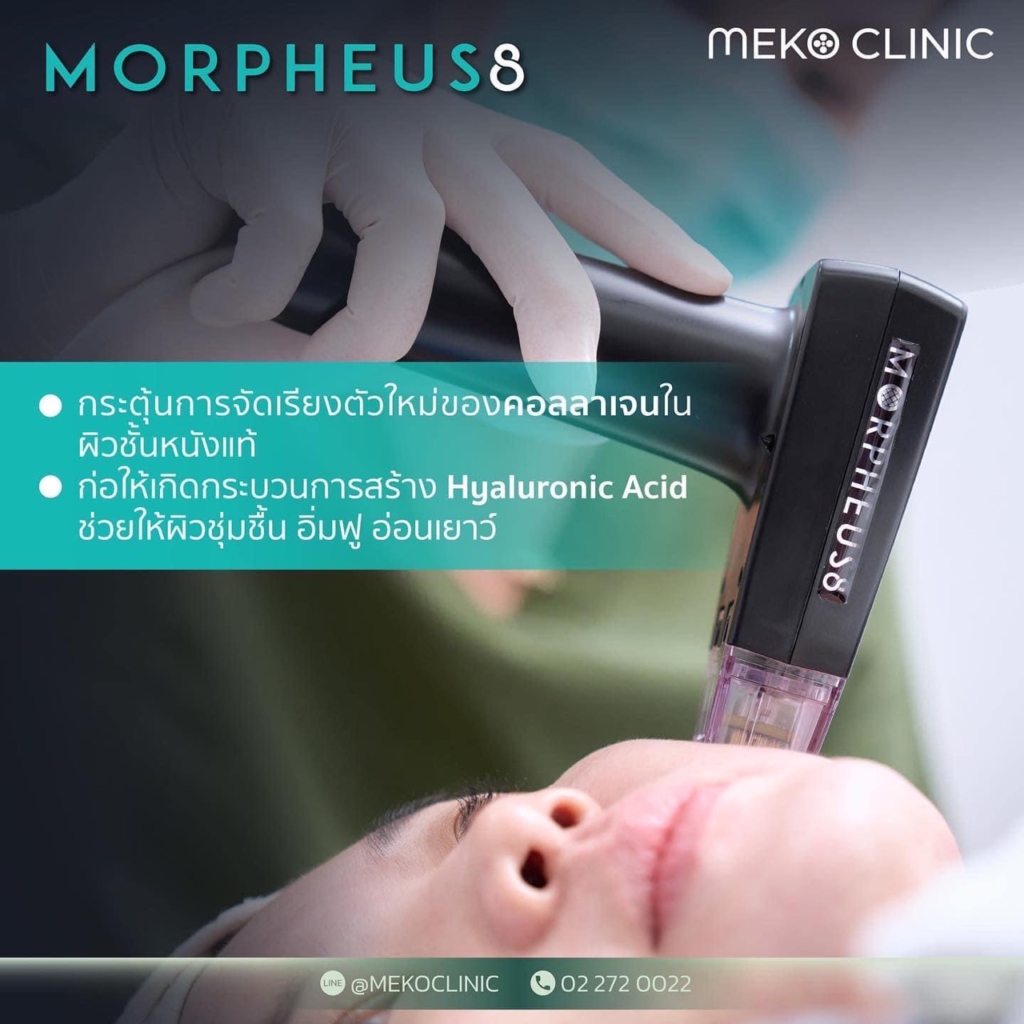 Morpheus8 กู้ผิวยับ ยกผิวหย่อน นวัตกรรมใหม่ยกกระชับผิวโดยไม่ต้องผ่าตัด-5