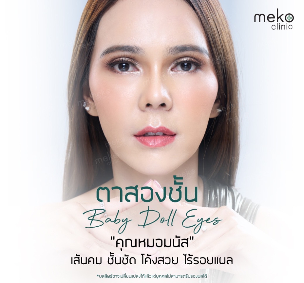 ศัลยกรรมตาสองชั้น ( Eyes Surgery ) ทำไมต้อง เมโกะ คลินิก ?