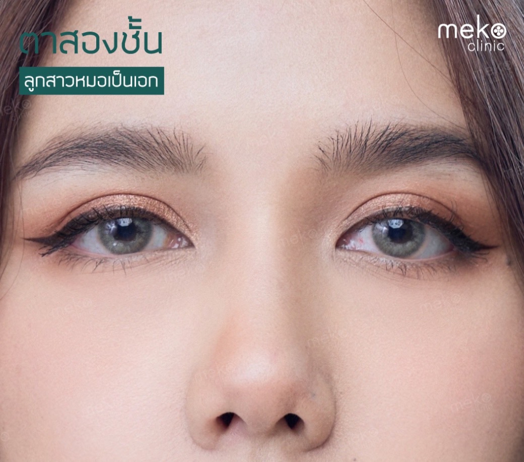 ตาสองชั้นลูกสาวหมอเป็นเอก-1