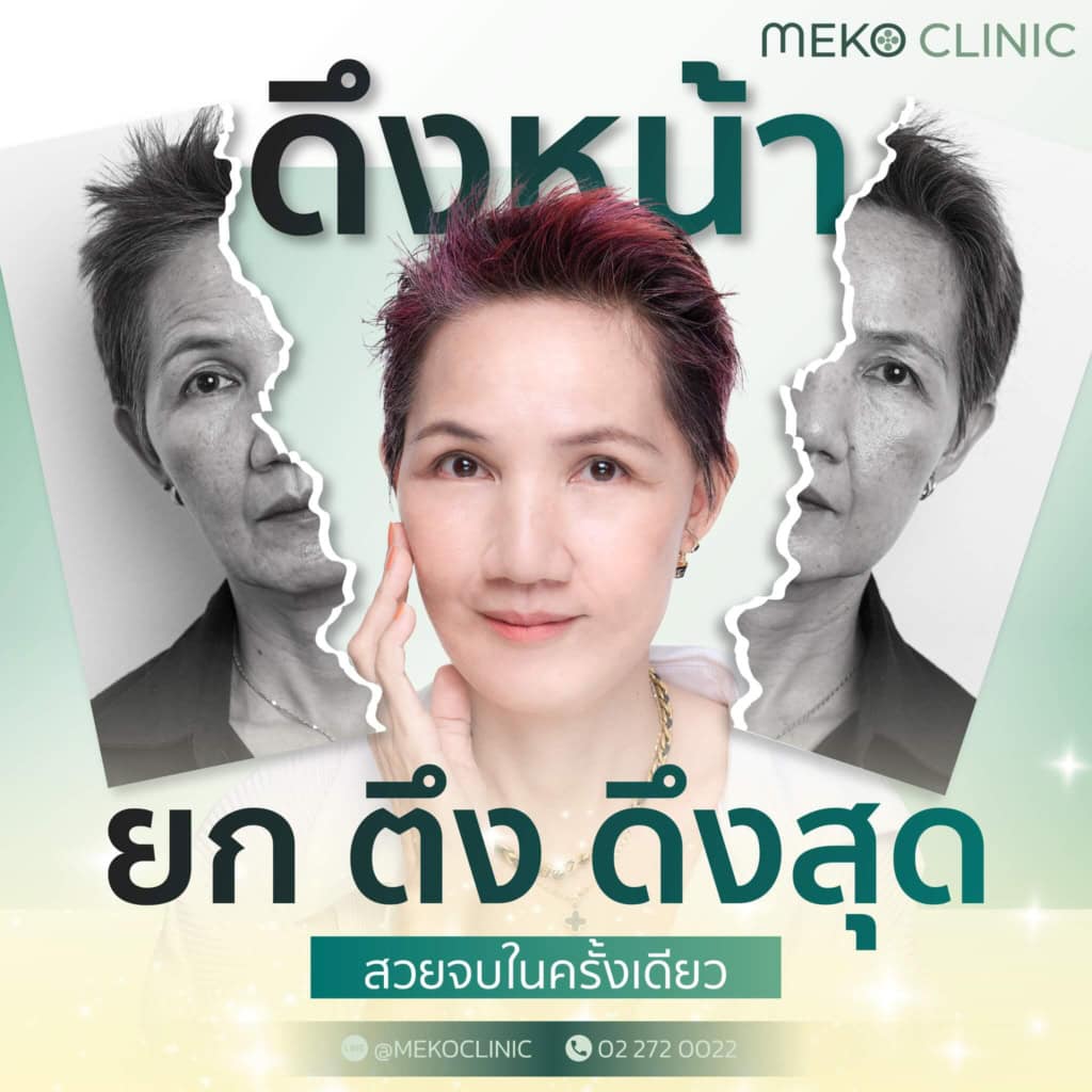 การทำศัลยกรรมดึงหน้า (Radiant Face Lift) คืออะไร มีประโยชน์อย่างไร ...