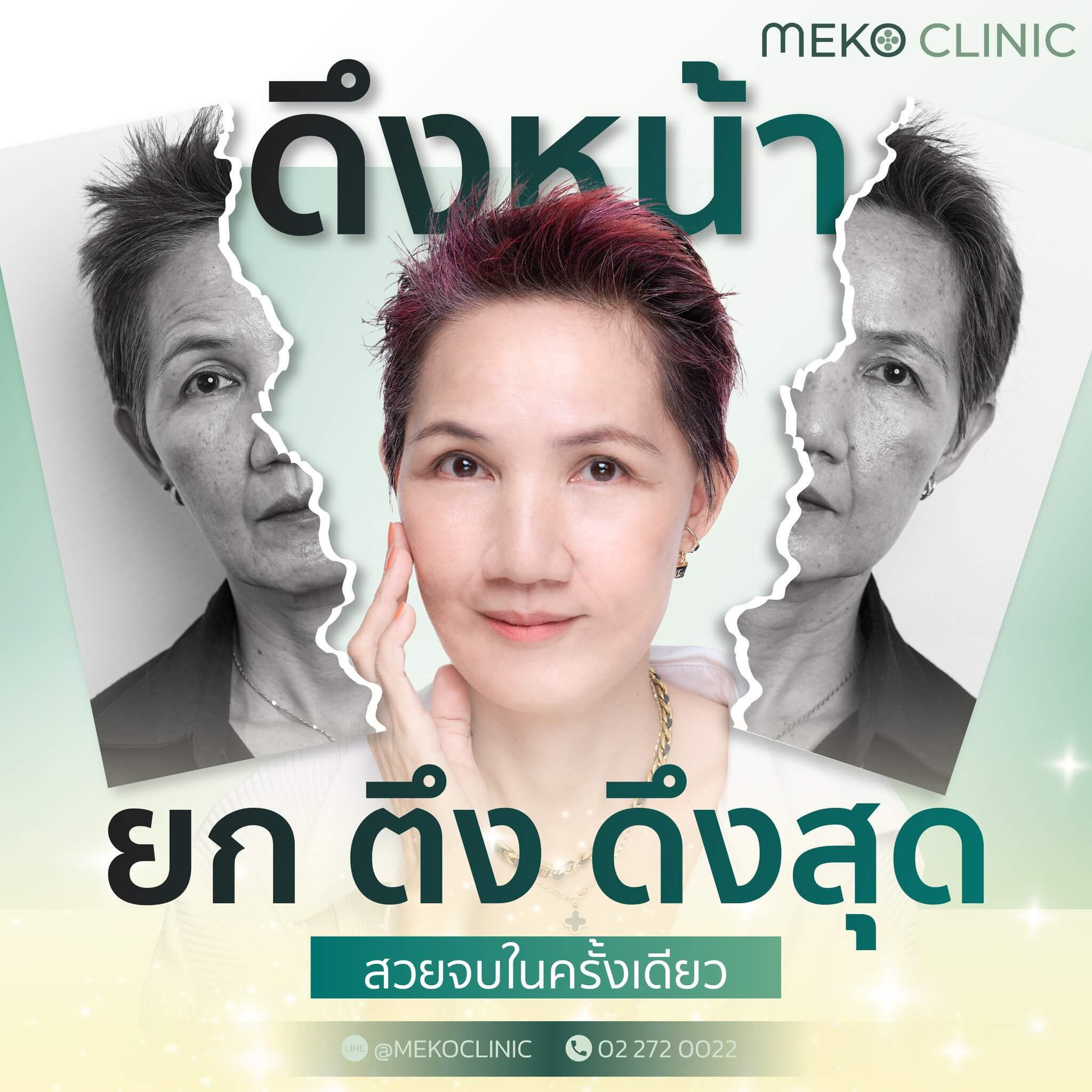 การทำศัลยกรรมดึงหน้า (Radiant Face Lift) คืออะไร มีประโยชน์อย่างไร