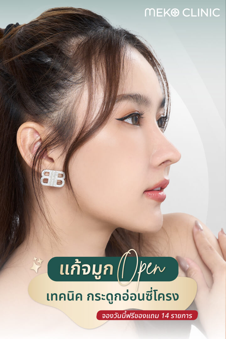 รีวิวศัลยกรรมแก้จมูกเทคนิค Open ด้วยซี่โครง และยืดผนังกั้นจมูกแบบตอกฐาน คุณโซดา-1