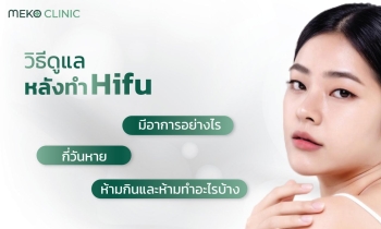 วิธีดูแลหลังทำ Hifu มีอาการอย่างไร กี่วันหาย ห้ามกินและห้ามทำอะไรบ้าง