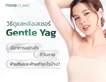 วิธีดูแลหลังเลเซอร์ Gentle Yag มีอาการอย่างไร กี่วันหาย ห้ามกินและทำอะไรบ้าง